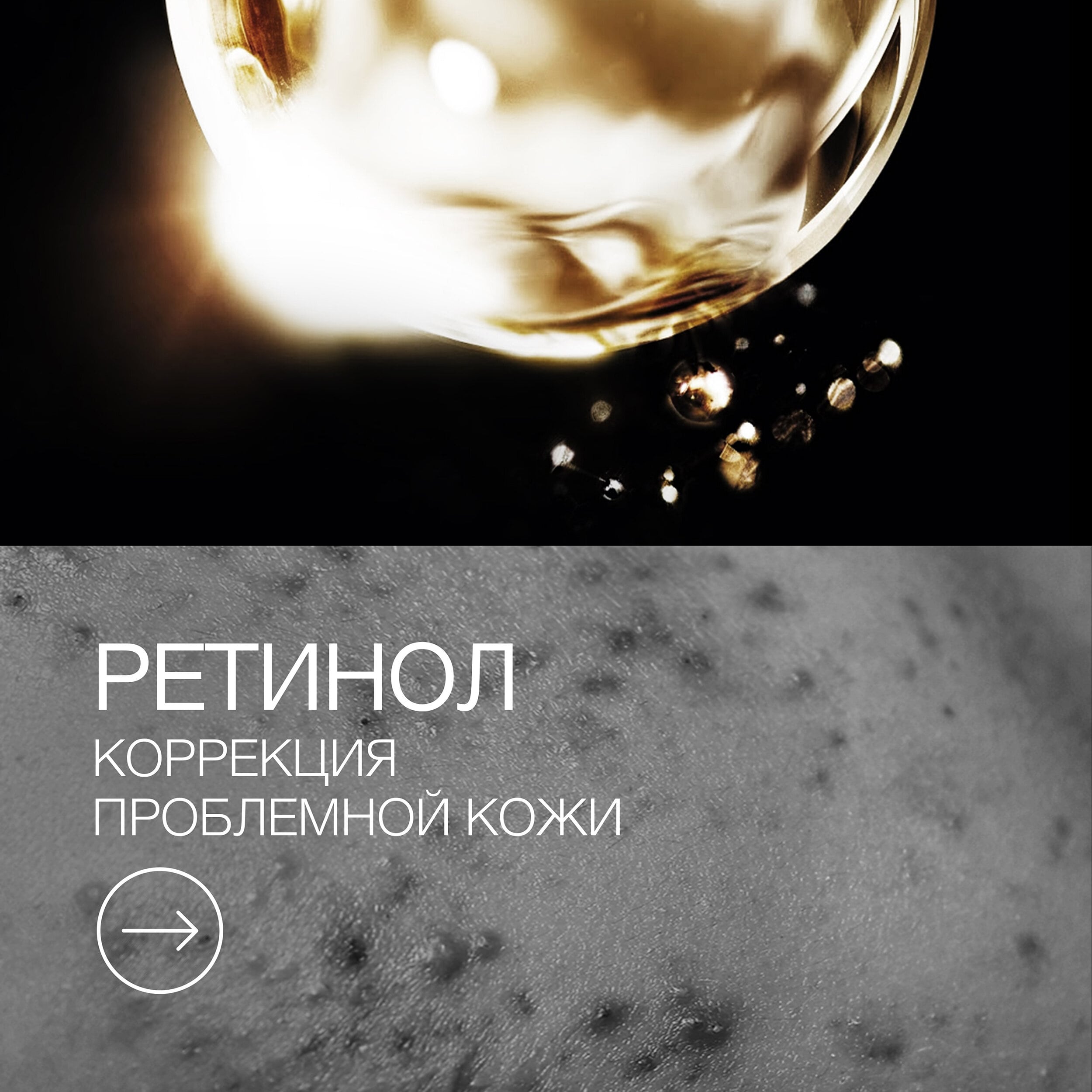 Пост Акне и ретинол 2.jpg Пост Акне и ретинол 2.jpg